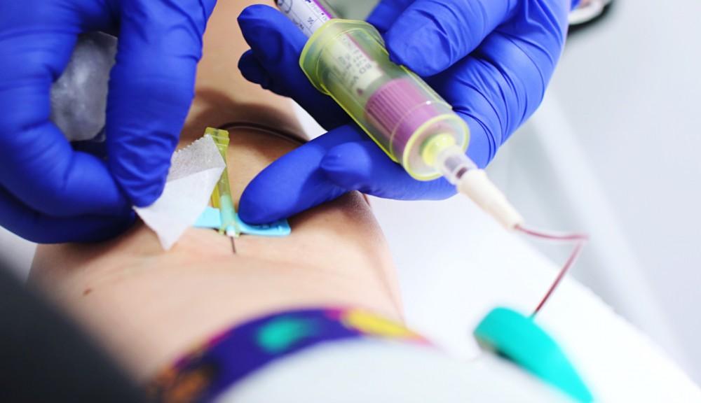 A Prostate-Specific Antigen test is performed by taking a blood sample